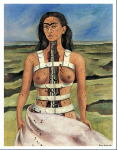La Columna Rota, Frida Kahlo, Museo Dolores Olmedo
